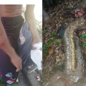 Dok. Korban Akibat Gigitan Ular Piton